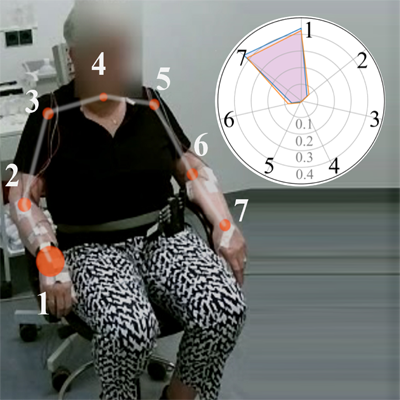 Pose-Based Tremor Type and Level Analysis for Parkinson’s Disease from Video